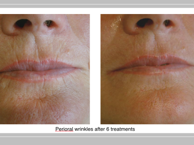 Screen Shot 2020-08-31 at 3.41.00 PM