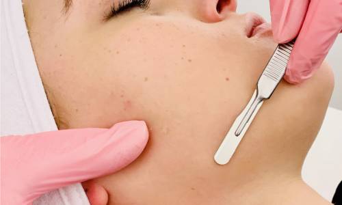 atalla-dermaplane-2020